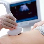 ultrasound scan